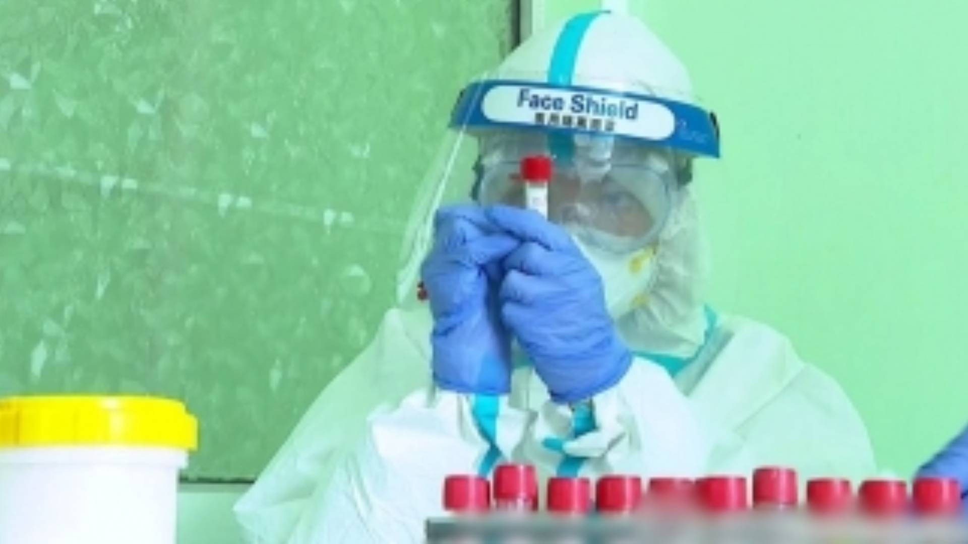 Five Of A Family In Telangana Test Positive For Covid