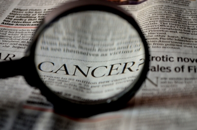 Study Finds 187 New Genetic Variants Linked To Prostate Cancer
