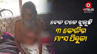 ଚିକିତ୍ସା ପାଇଁ ଅର୍ଥ ସାଜିଛି ବାଧକ, ୧୦ ବର୍ଷ ହେଲା ଟିଉମର ରୋଗରେ ଆକ୍ରାନ୍ତ
