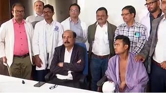 Doctors at SCB MCH successfully reconstruct right thumb finger with left toe finger
