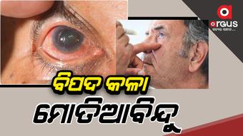 ୨୦୪୦ ବେଳକୁ ୧୧.୨ କୋଟି ଲୋକଙ୍କୁ ହେବ ଗ୍ଲୁକୋମା
