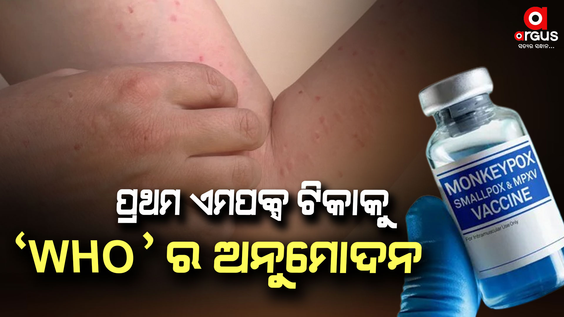 ମଙ୍କିପକ୍ସର ପ୍ରଥମ ଟିକାକୁ ମିଳିଲା ଗ୍ରୀନ ସିଗନାଲ