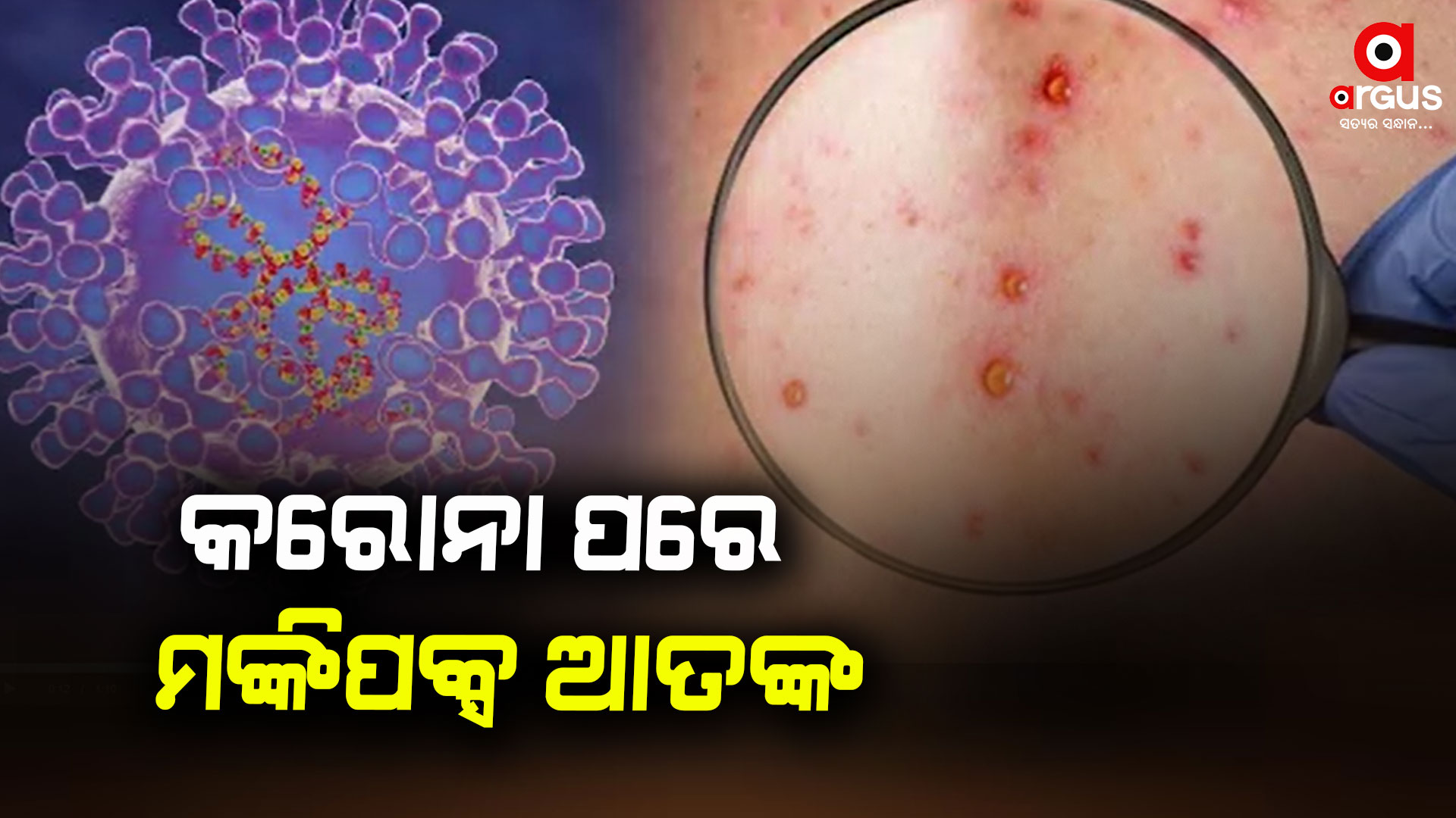 ବିଶ୍ବ ପାଇଁ ନୂଆ ବିପଦ ମଙ୍କିପକ୍ସ