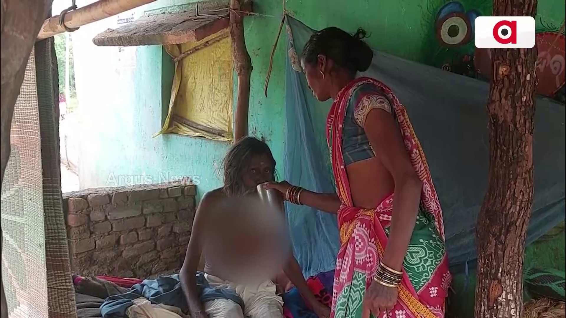 ବେକ ତଳେ ଝୁଲୁଛି 3 କେଜିର ମାଂସ ପିଣ୍ଡୁଳା !